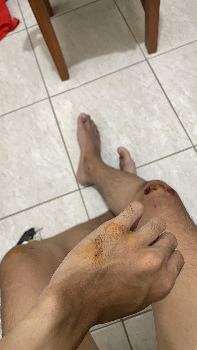 urd0se's tweet photo. Gue udah sebabam belur ini masih ditambahin mencahin teka teki🙏🏻 https://t.co/d8zuol22MH