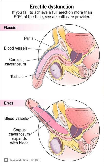 PoderMentalX's tweet photo. 8 Formas Naturales de Corregir Erecci0nes Blandas y la Falta de Deseo.

(Los Médicos No Te Dirán Estas)

1. Luz Solar Matutina (10–30 Minutos) https://t.co/S66HrYp2se