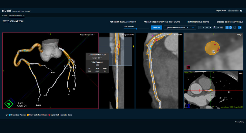 MPOmagazine's tweet photo. .@ElucidBio augments its Plaque-IQ software suite: https://t.co/5KkqEEbP6z https://t.co/rHC5AuF7NK
