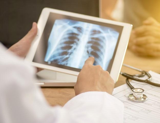 CIDRAP's tweet photo. Teen tuberculosis (TB) survivors may have reduced lung function, disability for up to 2 years post-treatment
Adolescent tuberculosis patients have persistent, symptomatic chronic lung disease despite bacteriological cure.
Read more: https://t.co/FoBlVJUtHf https://t.co/WG57bPy4et