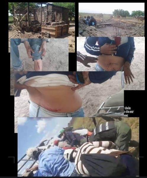 MundarayZair's tweet photo. #LALISTA En el No. 167 se postula Antonio Aaysenn Franco Tovar quien es el actual juez superior agrario de Apure protegido del gobernador y de Diosdado  Cabello, con sólo 14 años de graduado presentó un certificado falso de la Unellez de tener 15 años como profesor de derecho. Tiene decenas de denuncias por desalojos arbitrarios de campesinos, robo de tierras y de ganado. Su más reciente caso fue el desalojo de una señora de 104 años de un rancho el cual le tumbó y se apropió de los búfalos que estaban en el terreno, denuncia que reposa en el MP de Apure sin diligencia alguna. En los desalojos violentos se apoya con el ejército, han salido personas heridas. La comunidad afectada no sabe a dónde acudir frente a las ateocidades que ha cometido en ejercicio de "funciones".
