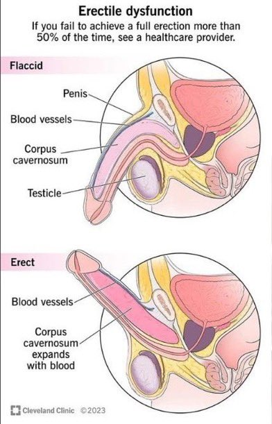 darw1nsz's tweet photo. 9 Vitaminas recomendadas para hombres que sufren de disfunción eréctil 

(Estas son cosas de las que no hablan muchos médicos)

1. Vitamina D3 https://t.co/OFFBdbYOt1