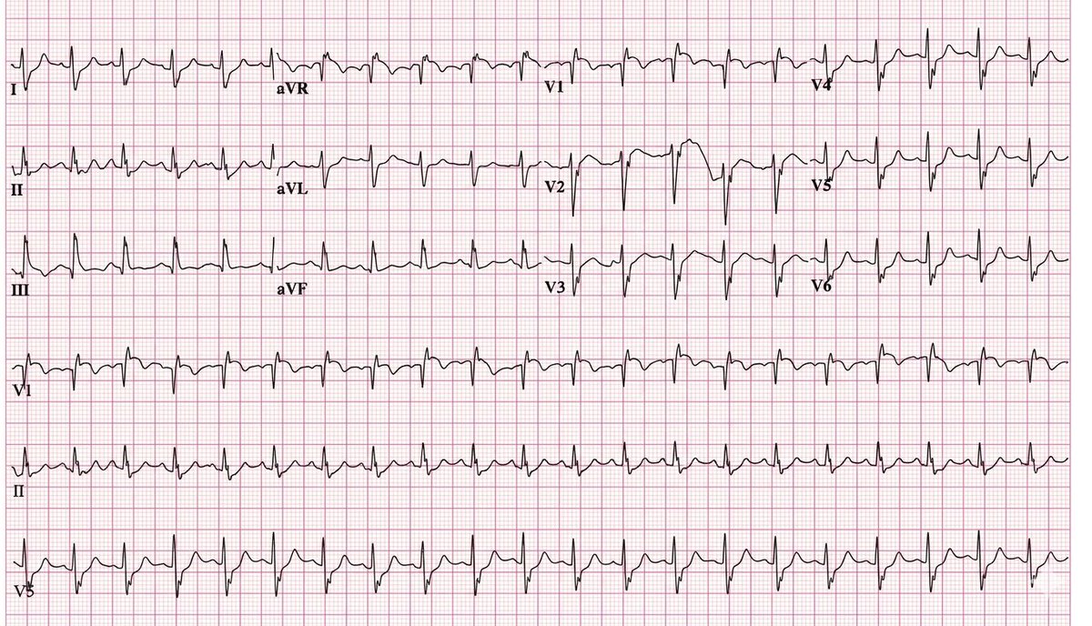 CardiovascularCorner tweet media