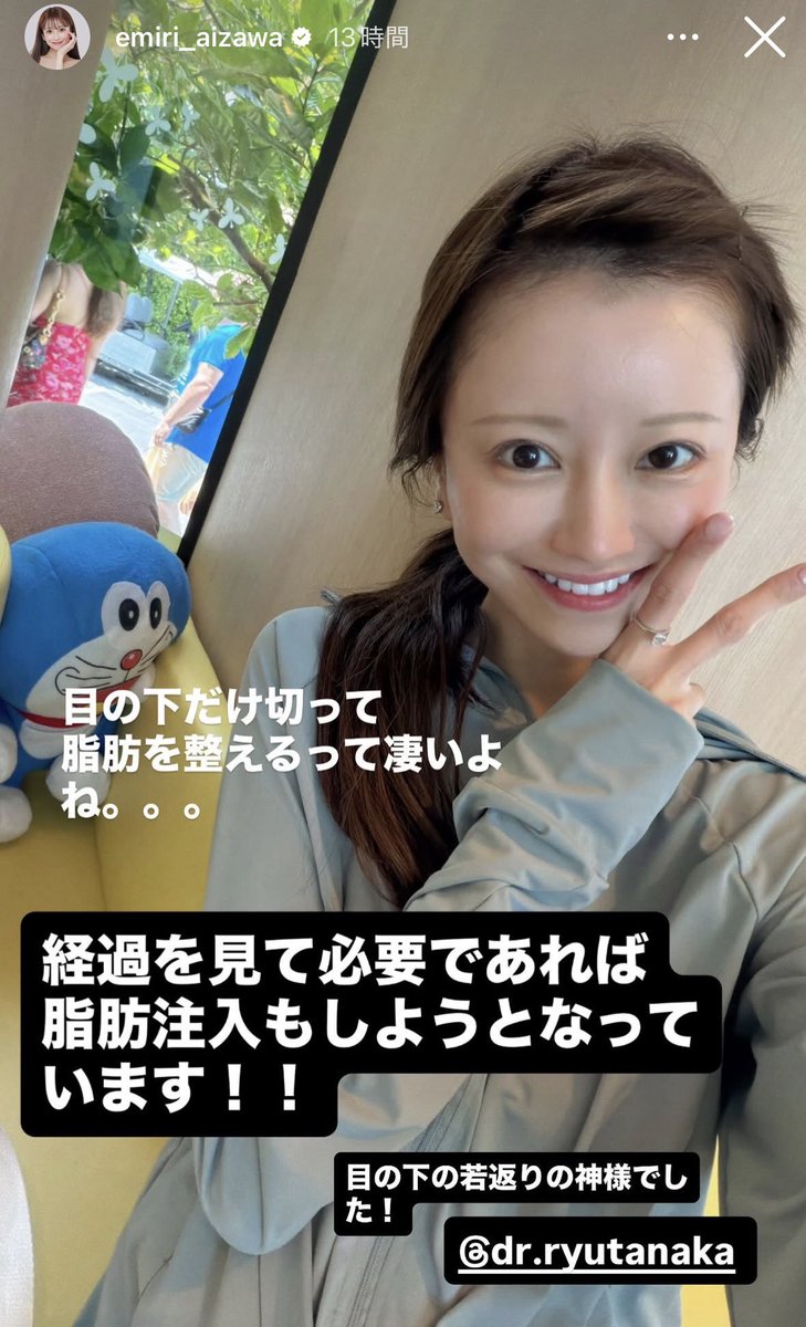 melonchan2021's tweet photo. ミッドチークリフトっていわゆる表ハムラ？
こないだ切開リフトして今度は表ハムラってすごくハイペースに感じるけど‥
ラストコールの影響かな

とはいえ今年裏ハムラを検討してるので参考にはなる

表ハムラは切開リフトより痛い_φ(･_･ https://t.co/Np98sVslnf