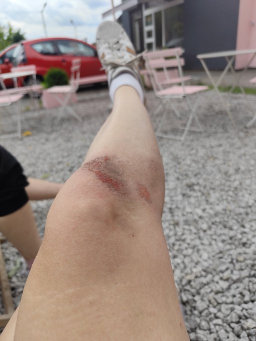 Medelainexx - 2 pic. Do you like football? I'm rough player 😜 #footballgirl #soccergirl #transinpublic #beautifultgirl #scratches https://t.co/gkP11F9pBC