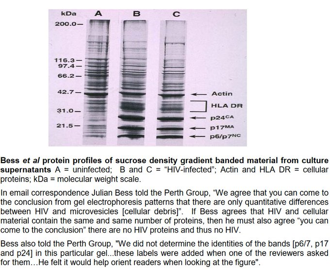 JamieAA_Again's tweet photo. The HIV HOAX.  

Julian Bess et al looked at protein analysis of infected "HIV" and uninfected cultures.   

They found supposedly specific "HIV" proteins in the uninfected cultures.  

Confirmed by Bess himself that they were only "Quantitative differences" https://t.co/FrG56bs4OC