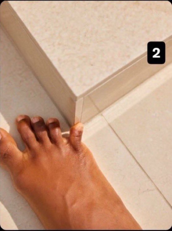 SolomonSunday_'s tweet photo. A or B
Which is more painful 😭😭😭

I hate both 😭 https://t.co/ju7NeTXzli
