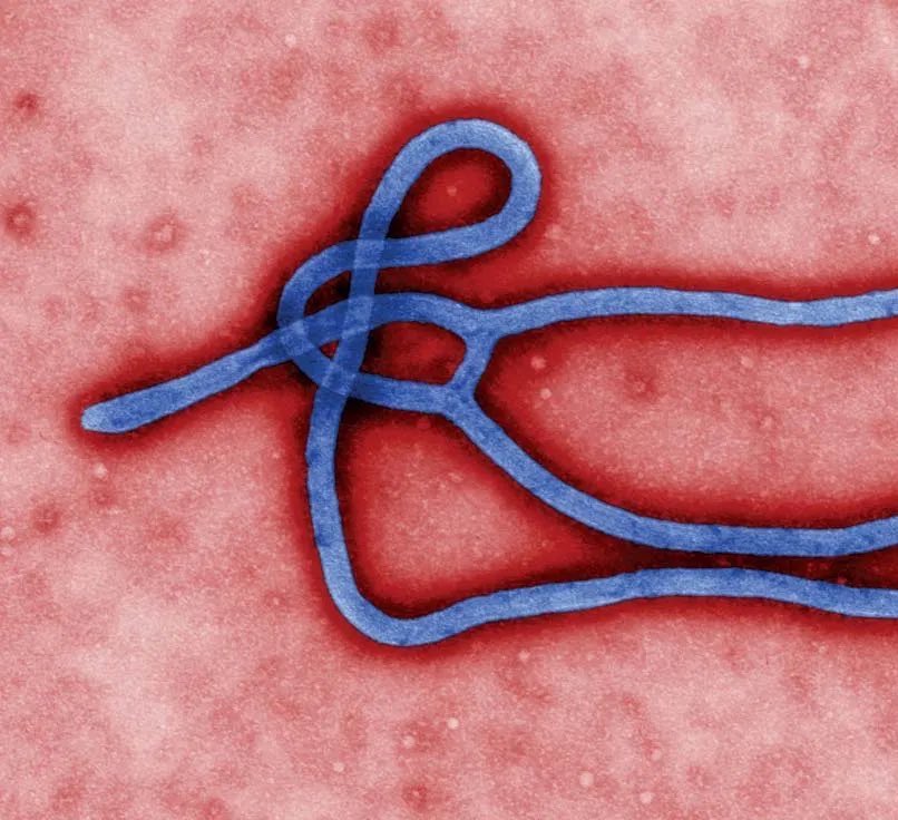 PopBase's tweet photo. France has confirmed its first Ebola case in connection to the outbreak in the Democratic Republic of the Congo.

Reports say there is currently no indication of local spread. https://t.co/4brKzYlLz3