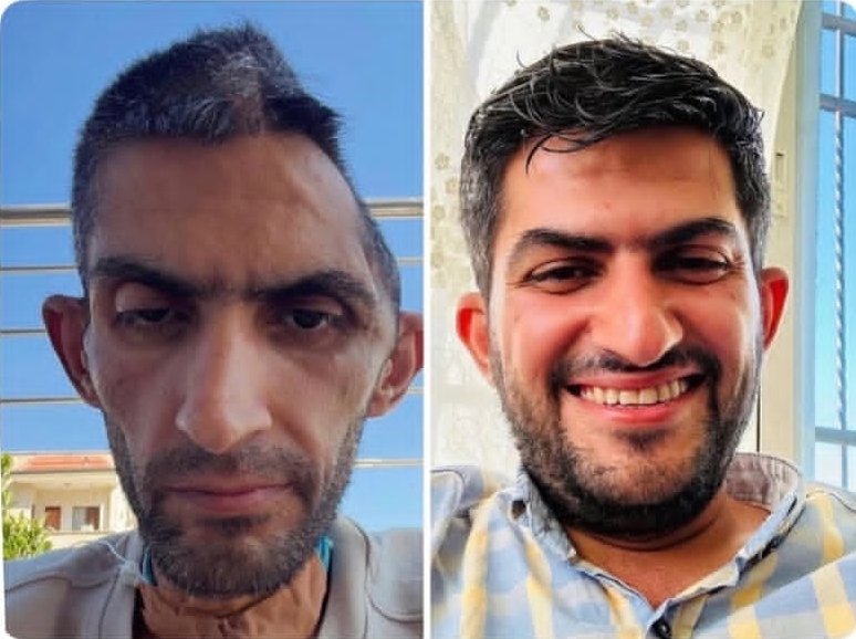 hanane12052003's tweet photo. Avant et Après 14mois de detention aux prisons de la seule démocratie du Moyen-Orient du Journaliste rédacteur en chef Moujahid Bani Mefleh. https://t.co/2rKdqUH1LH