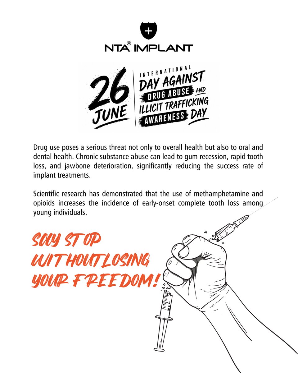ntaimplant's tweet photo. Drug use has serious negative effects on oral and dental health and introduces multiple factors that may lead to implant failure.

Effects on the Immune System: Drug use weakens the immune system and increases the risk of infection. The use of non-sterile needles may transmit serious infections such as Hepatitis and HIV. This condition can lead to peri-implant infections and failure of the osseointegration process of dental implants.

Bruxism (Teeth Grinding): Drug use may trigger bruxism by affecting the nervous system. Bruxism creates excessive forces on implants. This overload can result in mechanical complications such as implant fracture or loosening. The presence of bruxism significantly increases implant failure rates.

Cardiovascular Complications: Drugs such as cocaine create severe stress on the cardiovascular system. During or after implant surgery, these complications may endanger the patient’s overall health and reduce the safety of surgical procedures.

Lesion Formation: Drug use may cause various lesions in the oral cavity. These lesions impair the health of peri-implant tissues and increase the risk of inflammation and infection around implants. This condition negatively affects implant stability and may lead to treatment failure.

Poor Oral Hygiene: Poor oral hygiene leads to plaque accumulation and the development of periodontal diseases.

In conclusion, drug use significantly compromises the success of dental implants. Therefore, individuals planned for implant treatment should be carefully evaluated regarding substance use. Patients with substance dependence should be encouraged to overcome addiction and improve their overall health in order to increase treatment success.

#ntaimplant #oralhealth #saynotodrugs
