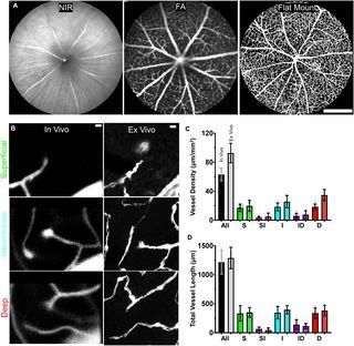 CvsUor's tweet photo. NEW from Fei Shang, Kosha Dholakia, &amp; @schalleklab One year of hyperglycemia in the Ins2Akita mouse does not impart changes in retinal vascular patterning, published in PLOS One.
https://t.co/WDvjKSPr62 #URochesterResearch @FlaumEye https://t.co/UxYxzE7aUi