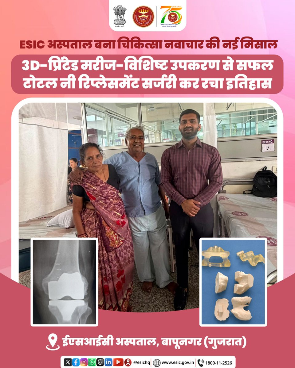 esichq's tweet photo. ESIC अस्पताल, बापूनगर (गुजरात) ने आर्थोपेडिक सर्जरी के क्षेत्र में एक महत्वपूर्ण उपलब्धि हासिल की है। 60 वर्षीय उच्च जोखिम वाले मरीज की घुटना प्रत्यारोपण (टोटल नी आर्थोप्लास्टी) सर्जरी 3D-प्रिंटेड मरीज-विशिष्ट उपकरणों की सहायता से सफलतापूर्वक की गई।

आर्थोपेडिक विभाग के डॉ. यश पटेल द्वारा की गई, इस सर्जरी में CT स्कैन आधारित 3D मैपिंग के माध्यम से उच्च सटीकता वाले विशेष उपकरण तैयार किए गए, जिससे बेहतर एलाइनमेंट और बेहतर उपचार परिणाम सुनिश्चित हुए।

यह उपलब्धि ESIC की आधुनिक, सुलभ एवं गुणवत्तापूर्ण स्वास्थ्य सेवाएं प्रदान करने की प्रतिबद्धता को दर्शाती है।

#ESIC #SocialSecurity #WorkersWelfare