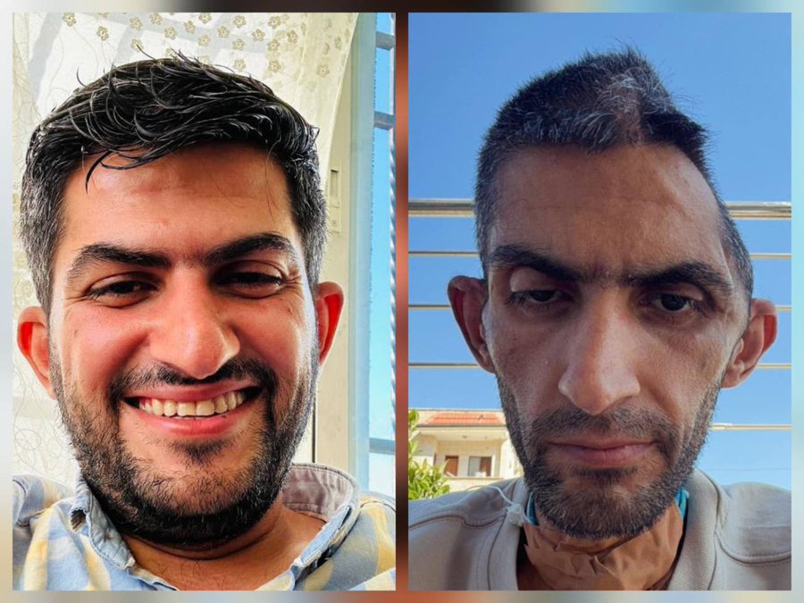 Bin_S_aeed's tweet photo. هكذا خرج الصحفي مجاهد بني مفلح من سجون الاحتلال الصهـ.. يوني بعد سجن 14' شهر https://t.co/wVEktG6VoA