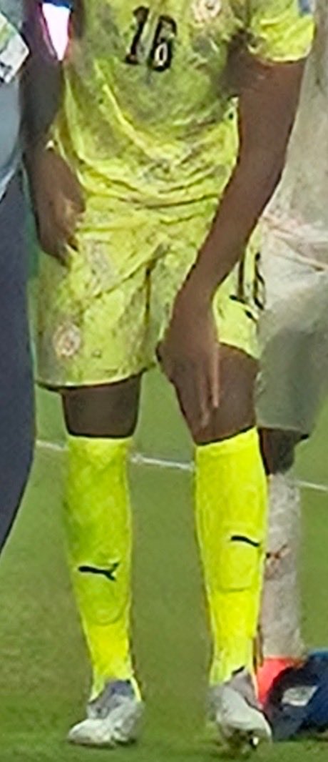 ABTHIAM1976's tweet photo. Bonne nouvelle pour nos Lions. L’IRM ne révèle pas de lésion méniscale sur la blessure de Edou. Il s’agit plutôt d’une entorse au genou par étirement du ligament interne. Il pourrait donc être opérationnel lors des 16emes. Oufff !!! https://t.co/tLLI21dniX