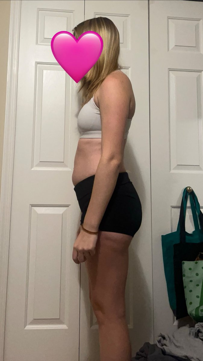 deaddweightt_'s tweet photo. here’s some before and after from january to now (-25lbs) https://t.co/IIF5MplIpB