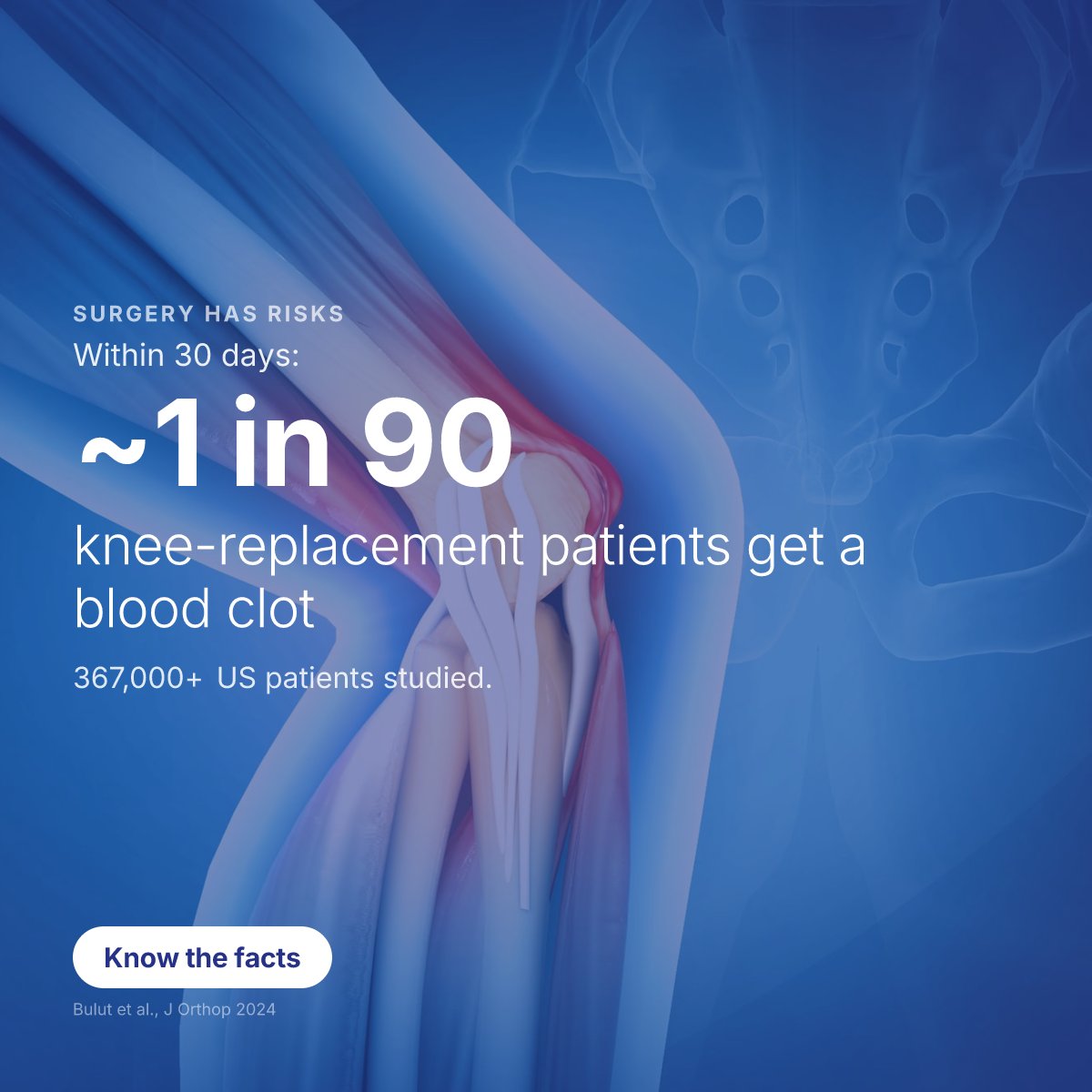 biosplice's tweet photo. Knee replacement is major surgery with real risk: in a study of more than 367,000 US patients, about 1 in 90 developed a blood clot within 30 days. #KneeOA https://t.co/8RFvSmYZQT