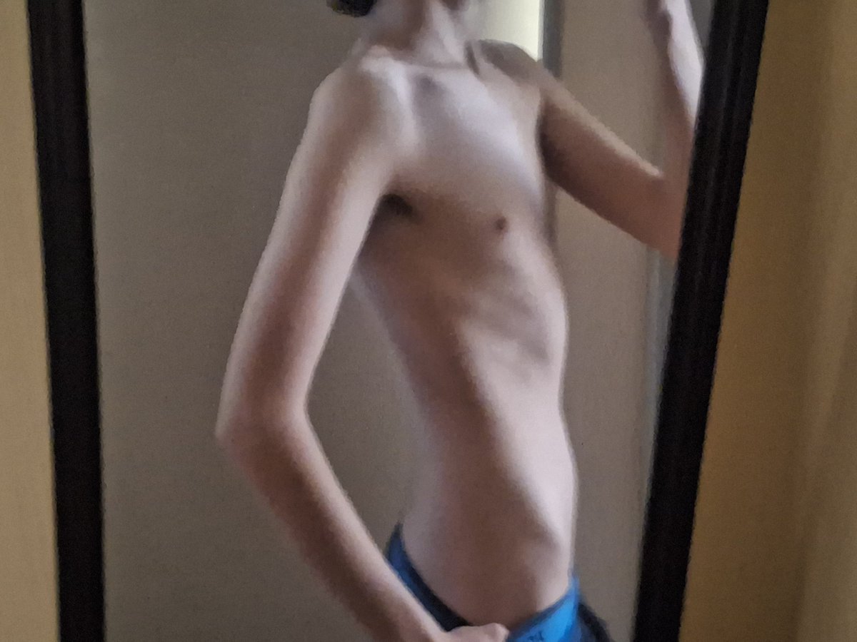 videnteeee's tweet photo. when will my bones become fucking visible #edrtwt #bodycheck https://t.co/Gd3Mf9NVxc