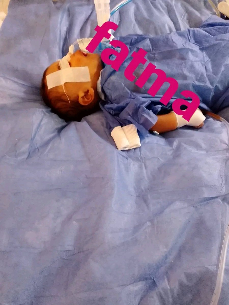 rahijij's tweet photo. سند عمل الاشاعه واتضح ان في تجمع مياه في المخ ومحتاج كشف دكتور مخ واعصاب وتدخل جراحي للاسف وطبعا مش هينفع يتنقل من مكانه نهائي لخطورة وضعه الصحي هنشوف عيادة دكتور يكون شغال في نفس المستسفي نعرض عليه الاشاعه لله الأمر من قبل ومن بعد 
ربنا يجازي كل من ساهم في حالة سند خير يارب https://t.co/G6Y2lozk9d