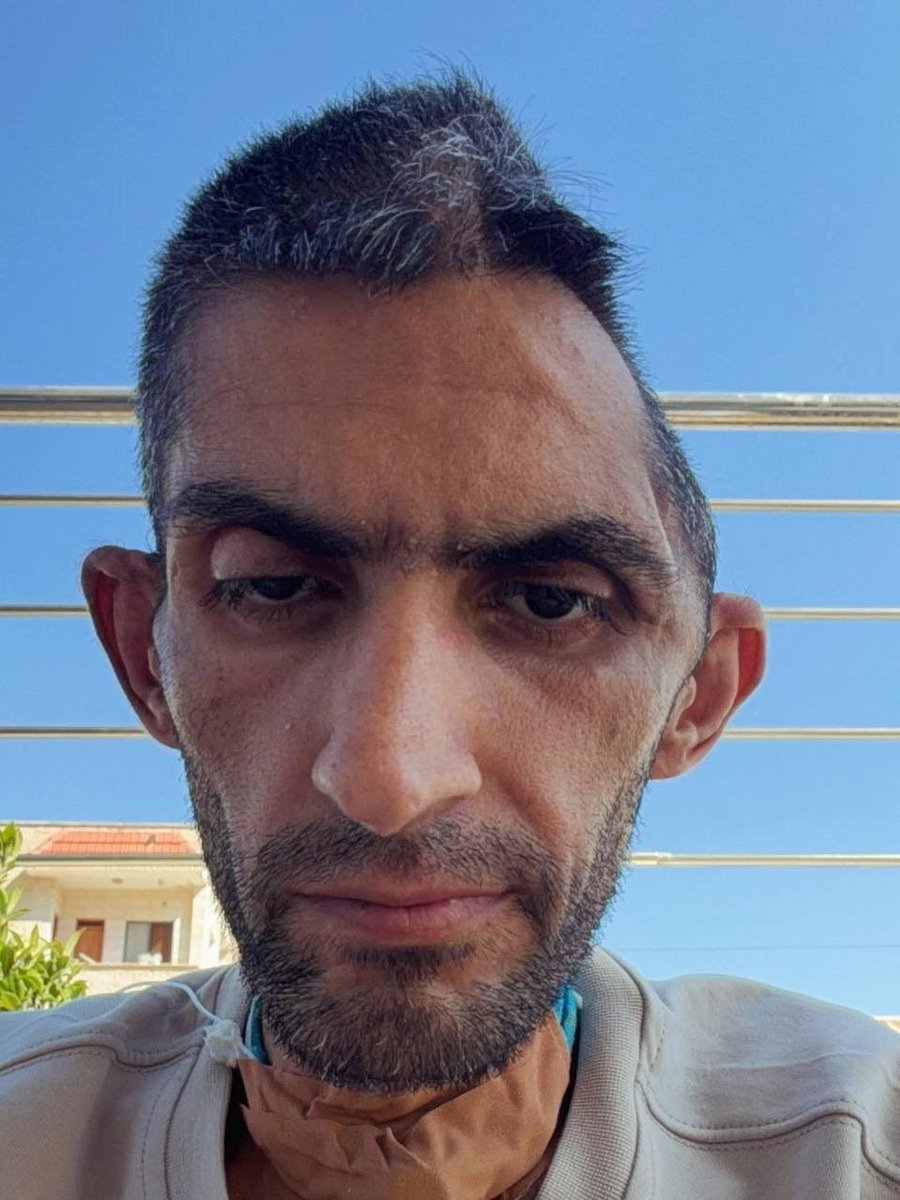SuppressedNws1's tweet photo. This is what ISRAEL did to Palestinian journalist Mujahid Abu Mufleh.

He was detained in Israeli prison for 6 and half months.

He then battled medical complications for almost 8 months due to being in Israeli prisons. https://t.co/CYfujqRecJ