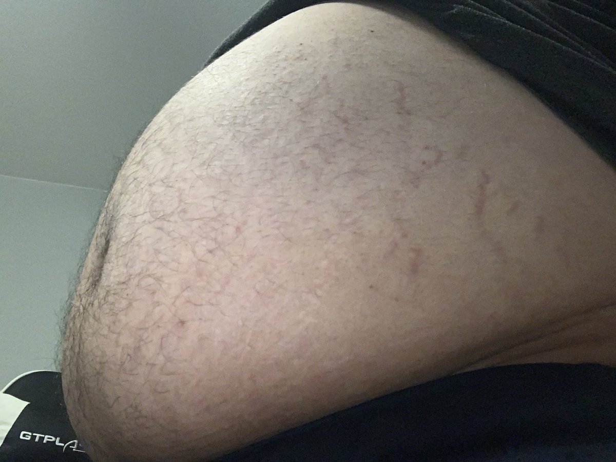 PancakeStackz's tweet photo. And here is the post belly pics. Fuuuuck I’m so full of pizza, pasta, and enough soda to where I stopped drinking once I felt like bursting. It sticks out a lot https://t.co/gRystnOJyW