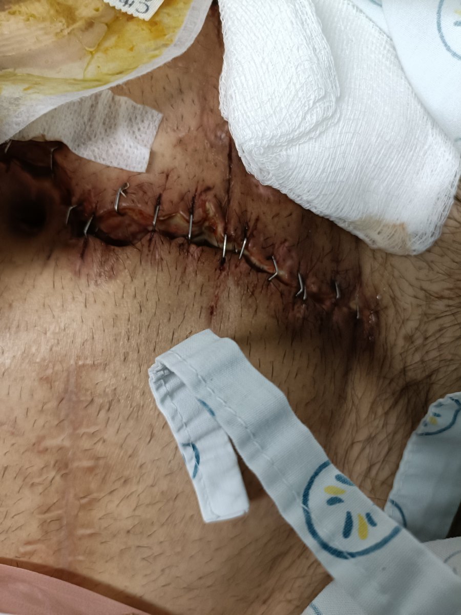 eddy_rb's tweet photo. @HRAEIxtapaluca @IMSS_Bienestar Para que quieren que los contacte por mensaje directo, borraron mi queja de su cuenta, por reportar las negligencias, asi trabajan sus pasantes de cirujanos. https://t.co/2VCy6Z8o9F