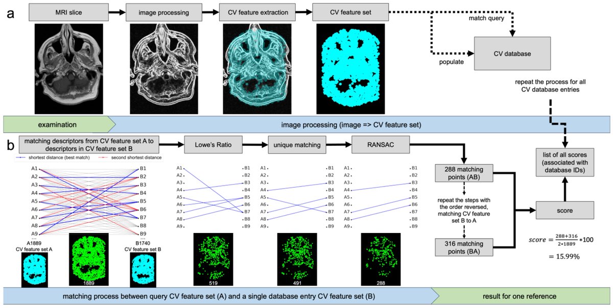 Bioeng_MDPI's tweet photo. ๐ Excited to share the Editorโs Choice Paper: Automatic Personal Identification Using a Single MRI Slice
Welcome to view this paper here๐ https://t.co/D9YMvscJnX
#computer_vision_systems #magnetic_resonance_imaging
#human_identification #head https://t.co/tsanKMOwUj