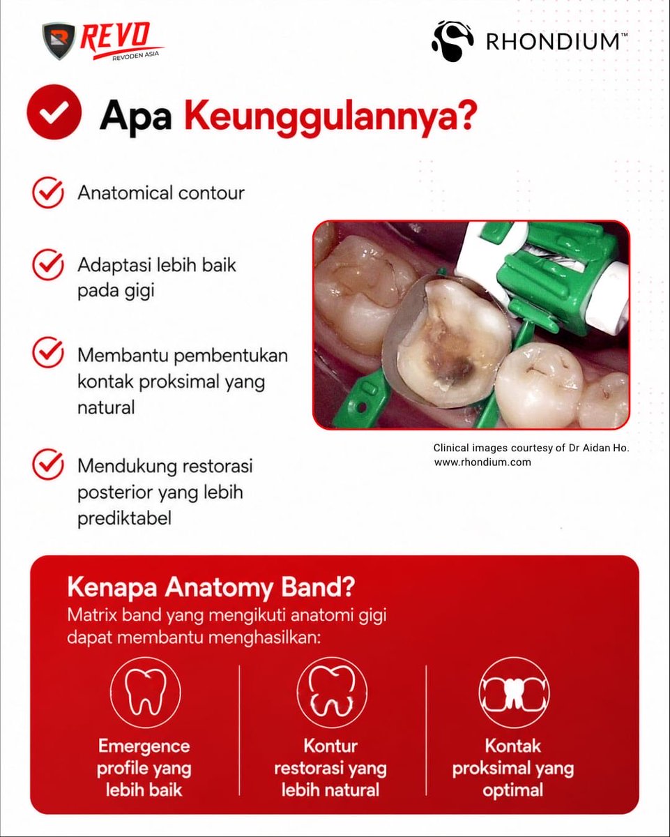RevodenAsia's tweet photo. 🦷 Kontak proksimal masih sulit terbentuk? Mungkin saatnya beralih ke matrix band dengan desain anatomis.
📩 Hubungi kami untuk informasi dan pemesanan.
#EvolvingToTheNextLevel #RevodenAsia #QuickConnect #AnatomyBand https://t.co/EmPUhlmofT