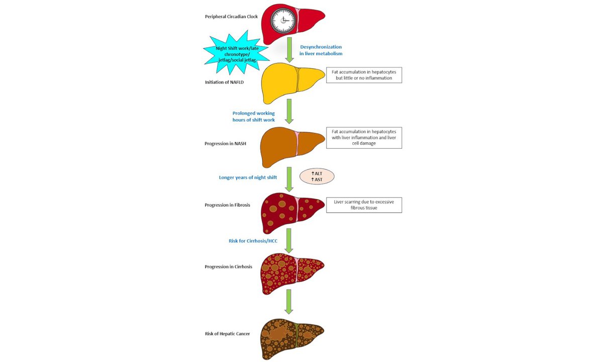 HepatomaRes's tweet photo. 🌟 Highly Cited Spotlight

🌙 Does Night Shift Work Increase Liver Cancer Risk?
Circadian disruption may accelerate NAFLD/NASH progression and increase HCC risk.

📖 Read more: https://t.co/c3sIJ8gxQz
#HCC #NAFLD #LiverCancer https://t.co/HwMjSR9HQt