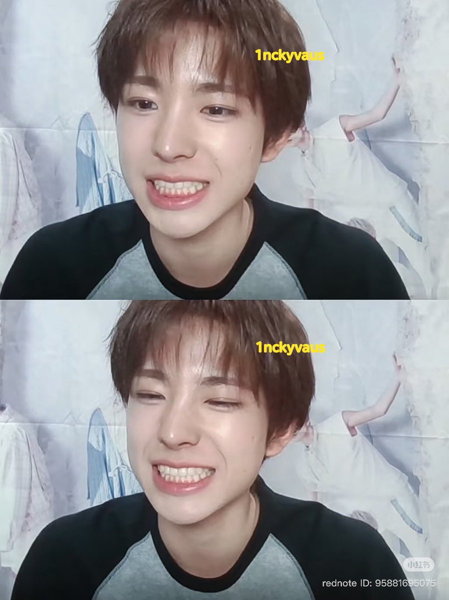 wishcyu's tweet photo. remember when someone asked yushi which part of his body that he likes and he said its his teeth while smiling exactly like this emoji 😁 https://t.co/mKACIk5kxM