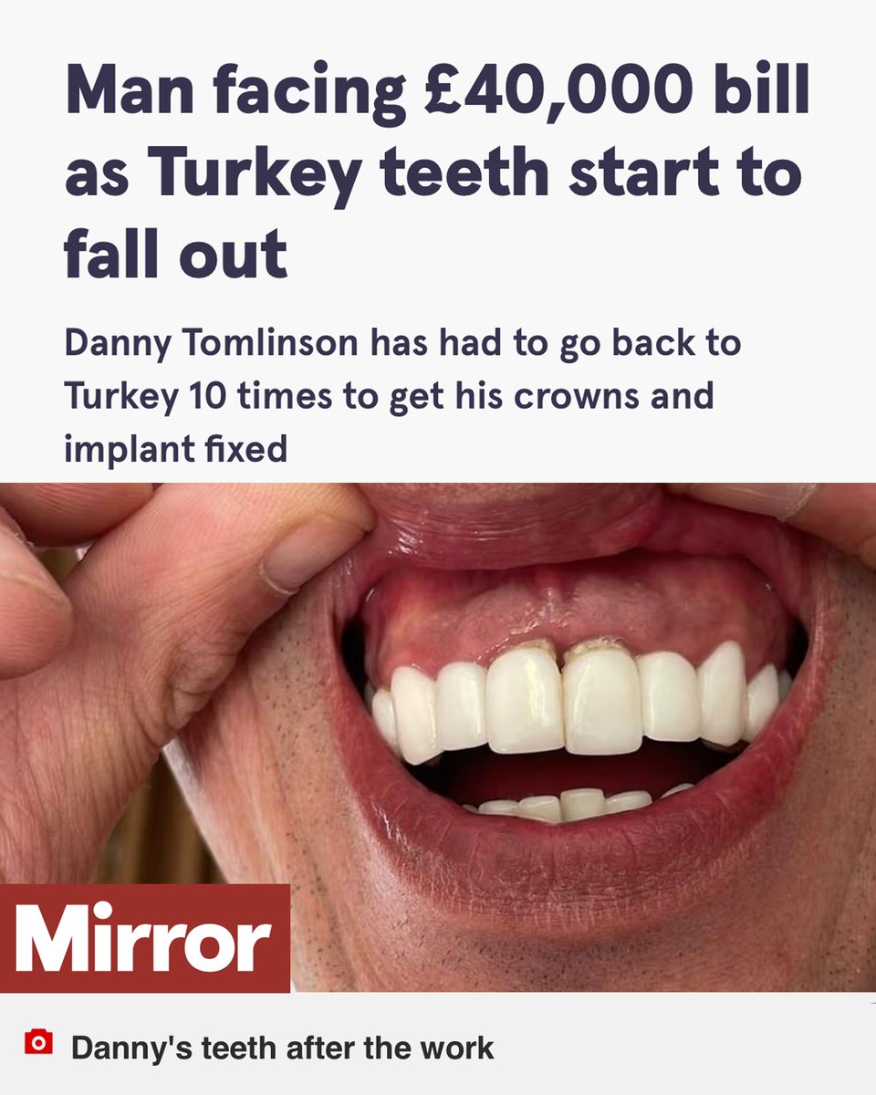 TheBDA's tweet photo. Danny expected them to last for years, but almost immediately, he noticed the bottom implants were loose.

He's faced a huge bill to put things right. 

With dental tourism, patients need to understand the risks. 

https://t.co/hfjvj2dZQJ https://t.co/nYxL18AB75