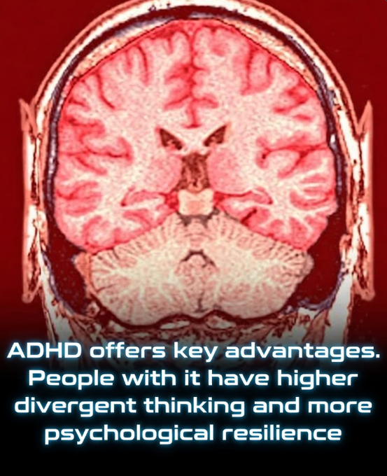 Rainmaker1973's tweet photo. Recent studies in neuroscience and psychology are reframing ADHD not merely as a set of cognitive hurdles but as a powerful driver of breakthrough creativity and innovation.

Long stereotyped for difficulties with focus, attention, and impulse control, individuals with ADHD traits often exhibit superior divergent thinking—the capacity to generate a wide array of novel ideas by connecting distant or unrelated concepts. This stems from reduced adherence to rigid mental frameworks, enabling freer conceptual expansion and the production of more original, unconventional solutions than neurotypical counterparts. Heightened mind-wandering, especially when deliberate (purposefully allowing thoughts to drift), acts as a fertile source for this creativity, bypassing conventional boundaries to yield abundant "outside-the-box" insights.

Complementing this cognitive flexibility is a neurological drive for novelty rooted in lower baseline dopamine signaling. This creates a chronic need for stimulation, translating into exploratory, risk-tolerant behavior and a propensity for adventure—qualities that can disrupt routine settings but prove invaluable in dynamic fields. Impulsivity, often reframed as rapid action initiation, becomes a catalyst for pursuing bold ideas and seizing opportunities in high-stakes environments.

These traits align closely with the profiles of many successful entrepreneurs, inventors, and pioneers. In fast-evolving creative and innovative economies, the ADHD brain's wiring for quick associative leaps, tolerance of uncertainty, and motivation through novelty-seeking provides a distinct edge, turning potential challenges into engines of originality and progress.

Emerging evidence from 2025–2026 research reinforces this view: studies link stronger ADHD traits to elevated creative achievements via mediated mind-wandering, intuitive insight-driven problem-solving, and higher real-world inventive output, highlighting neurodiversity's role in fueling societal advancement.

[Maisano, H., et al. (2026). ADHD Symptoms Predict Distinct Creative Problem-Solving Styles and Superior Solving Ability. Personality and Individual Differences (February 2026)]