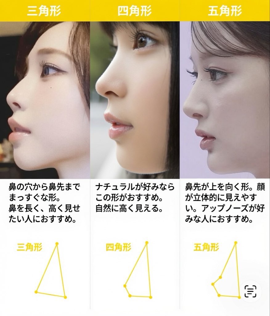 oxmfg2's tweet photo. 鼻整形で使えるオーダー資料。

鼻中隔延長、鼻尖形成、貴族手術にしても医者のセンスだけで好き勝手オペされるとだいたい修正になるんだけど、実態はミスマッチが起こるべくして起きる伝え方してるからなんよね。

鼻フルなんて準備で5割は決まってるから。 https://t.co/vo4YtmZWoR