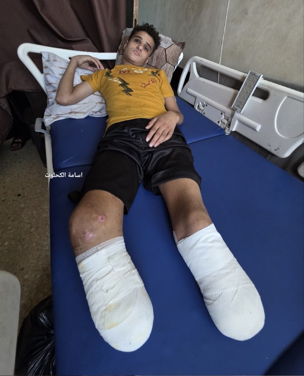 hamody_04's tweet photo. Mohammed Sarour, an aspiring athlete dreaming of a professional career, lost both of his legs in an explosion caused by unexploded military ordnance left behind in #Gaza. https://t.co/g0cEt3l7au