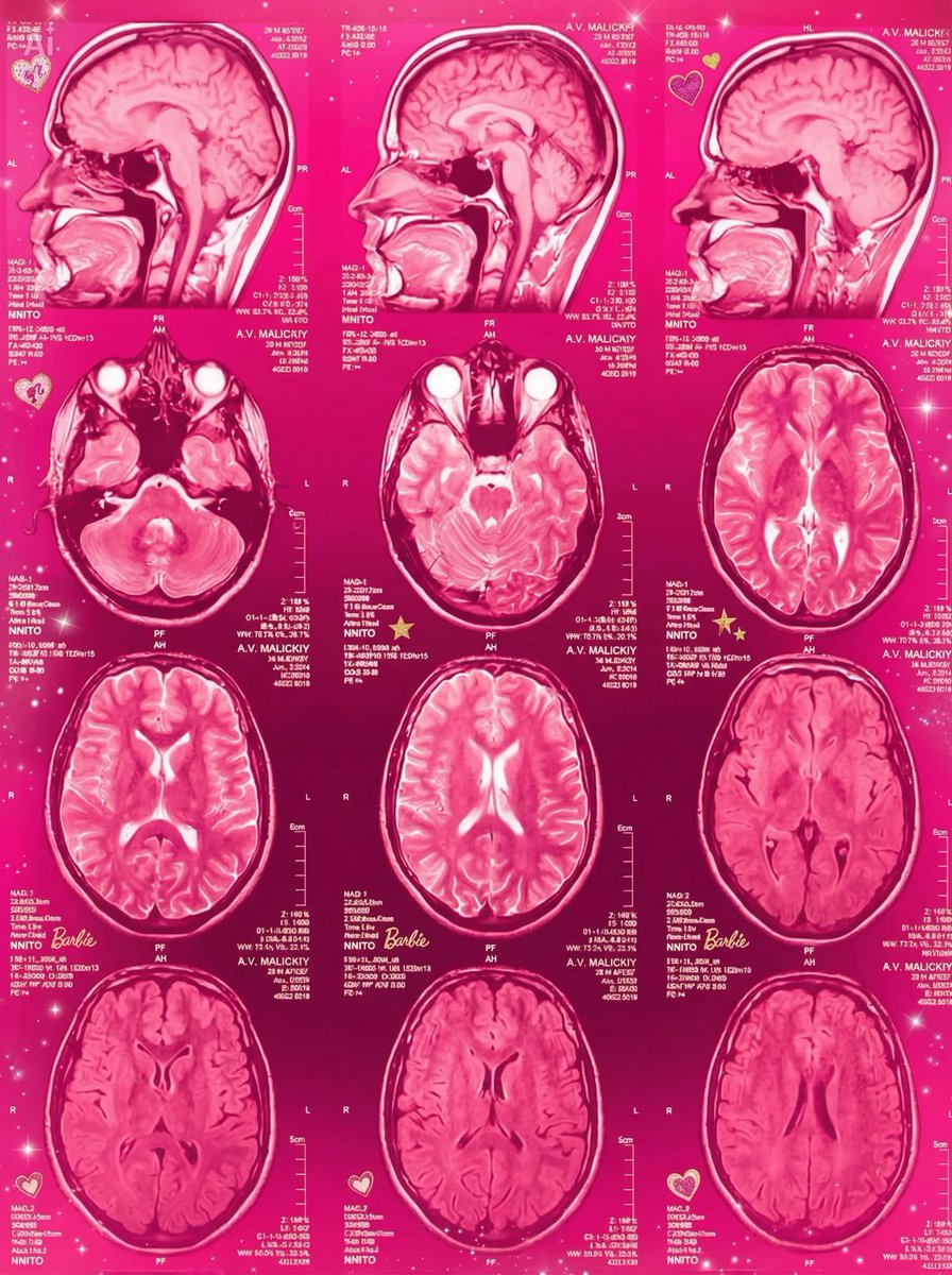 HealthyAlfred's tweet photo. scientists CRACKED open 10 Alzheimer’s brains. 9 had a living bacteria inside. eating their neurons.

P. gingivalis. the bacteria behind your bleeding gums.

it wasn’t just there. it was WORKING.

→ fragmenting neurons
→ cleaving TAU (neurons collapse)
→ destroying UBIQUITIN (waste builds)

then they proved it:

→ infected mice — brain colonized
→ neurons DIED
→ blocked enzymes — damage REVERSED

infect → damage. block → recovery. causation.

(Dominy 2019 — Science Advances)

your gums bled this morning. you spat blood. moved on.

that bacteria entered your blood. crossed into your brain. started digesting.

it doesn’t kill fast. it feeds for DECADES.

by the time you forget your daughter’s name — it’s been eating for 30 years.

mastic gum KILLED it (PMID: 16822220).

→ penetrates biofilms toothbrushes can’t
→ zero resistance in 3,000 years

you can’t cure Alzheimer’s.

you can kill what’s eating it.

🧵 here’s what else mastic gum kills ↓