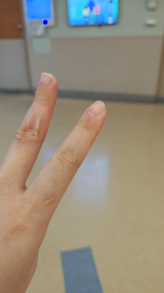 TakeOut0625's tweet photo. 今天跟家人去慶生了不會開台
去年的今天在醫院慶生
也認識了一群好朋友
願大家健健康康的
（生日回來醫院調藥） https://t.co/NJ8JZTdSjX