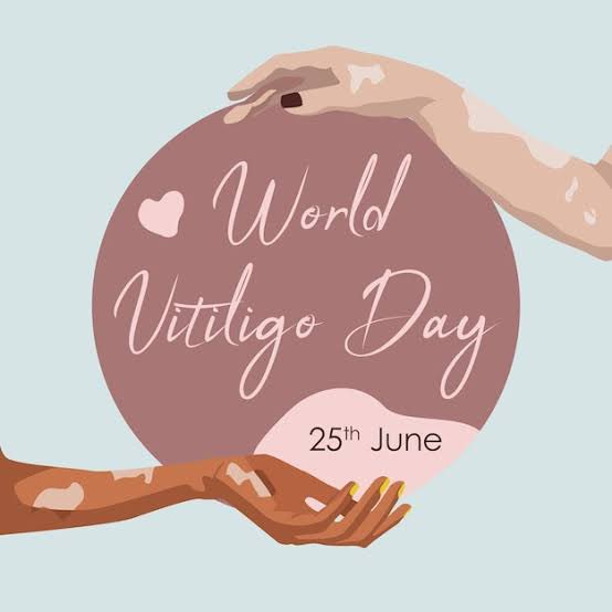deep_sleep_0's tweet photo. #WorldVitiligoDay
#세계백반증의날
오늘은 세계 백반증의 날입니다.
(전염성 없어요)
저도 백반증이 있어서 얼굴과 손, 몸 곳곳에 흰 반점들이 크게 있는데요
이 백반증이 취업 등의 상황에 불리하게 작용할 수도 있어요.
조금 다르게 생겼다해서 차별하지 않는 사회가 되면 좋겠습니다. https://t.co/PocE3vgi4j