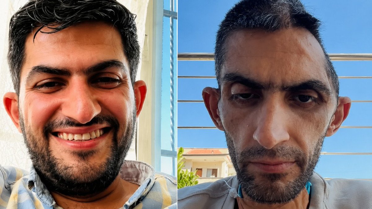mechuldivane's tweet photo. İsrail hapishanesinden tahliye edilen Filistinli gazeteci Mücahid Beni Müflih'in sağlık durumu ve işkenceden kalan acı görüntü, Siyonist barbarlıgin sadece bir örneği...:((

#FreeFilistin
#GazzeİçinHareketeGeç
#GazzedeZulümArşaDayandı
#Venezuela
#AşureGünü https://t.co/POfNfzzdhN
