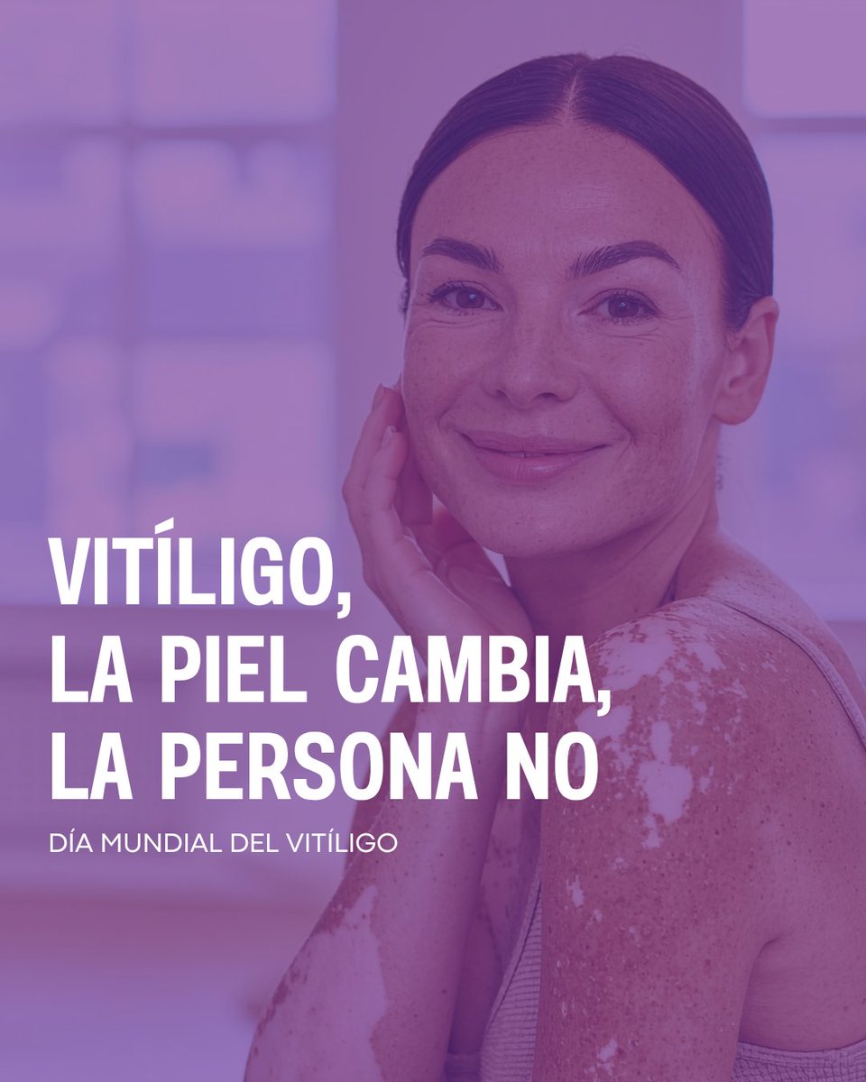 COFLeon's tweet photo. 🤍 En el Día Mundial del Vitíligo recordamos la importancia de visibilizar esta condición, fomentar la comprensión y combatir los prejuicios.

💚 La diversidad también forma parte de nuestra piel.

#diamundialdelvitiligo #vitiligo #COFLeón https://t.co/dcML9vznbB