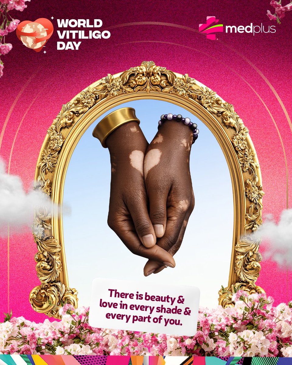MedplusPharmacy's tweet photo. Vitiligo is a reminder that beauty is not defined by uniformity, but by authenticity.

Today, we celebrate every shade, every patch, every expression of individuality.

Happy World Vitiligo Day.

#Worldvitiligoday #Medplus #MedplusPharmacy #MedplusYourFavouriteHealthPlug https://t.co/XJcidHzHox