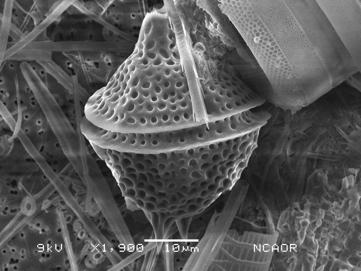 SahinaGazi's tweet photo. 'A Plankton Spacecraft'

What if alien spacecraft looked less like machines and more like plankton ? A marine dinoflagellate when reimagined through color resemble a spacecraft-an example of how microscopic life can inspire macroscopic engineering 🔬🚀

#Biomimicry #SEM #SciArt https://t.co/IAFkbtyXlP