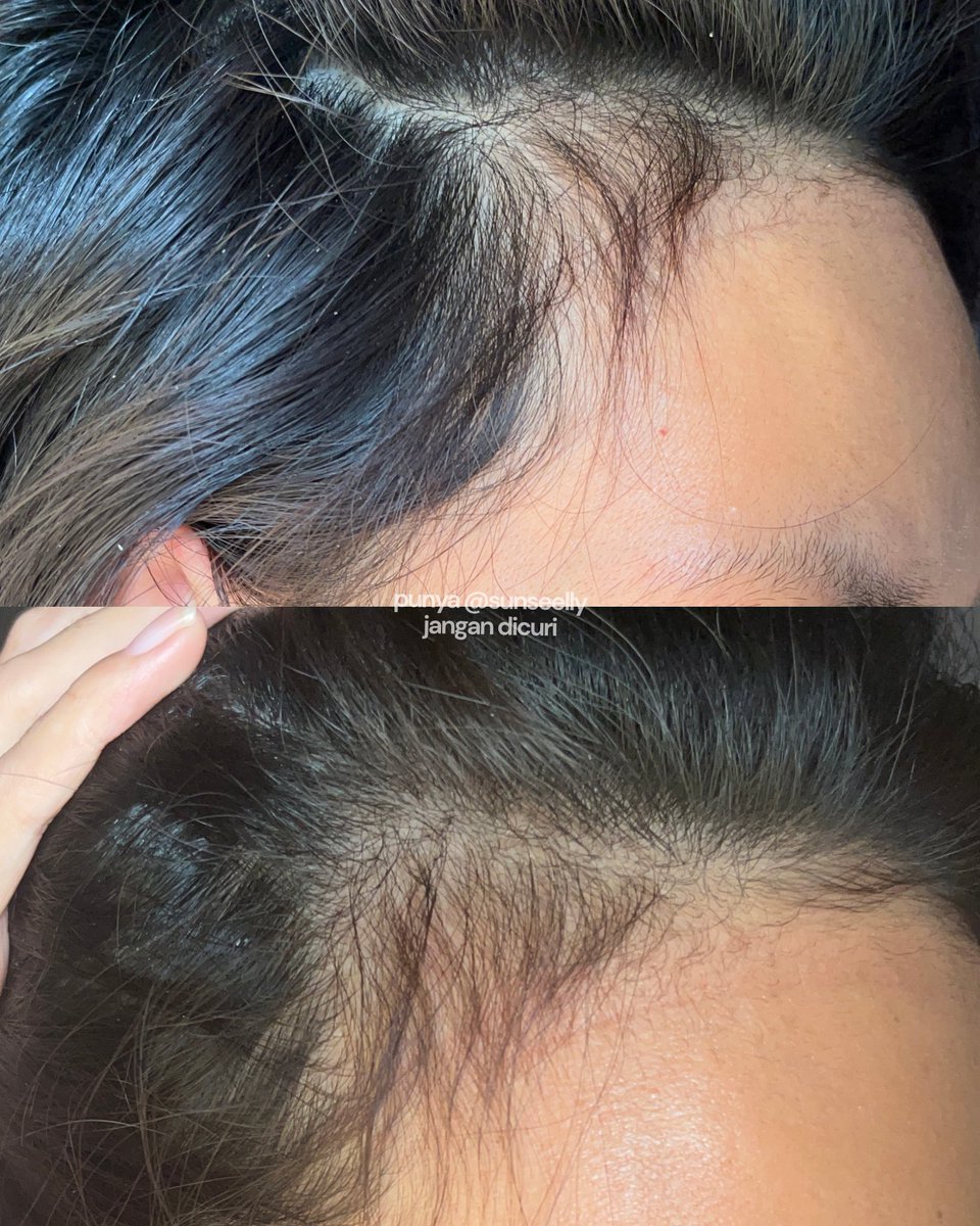 sunseelly's tweet photo. ‼️UPDATE‼️ baby hairnya udah sepanjang ini……. 🥹🥹🥹 https://t.co/vQSEK5ebeH