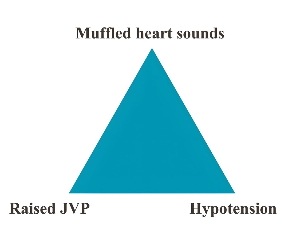 ChShafiullah15's tweet photo. The TRIAD is called? https://t.co/bt1J4xCBEZ