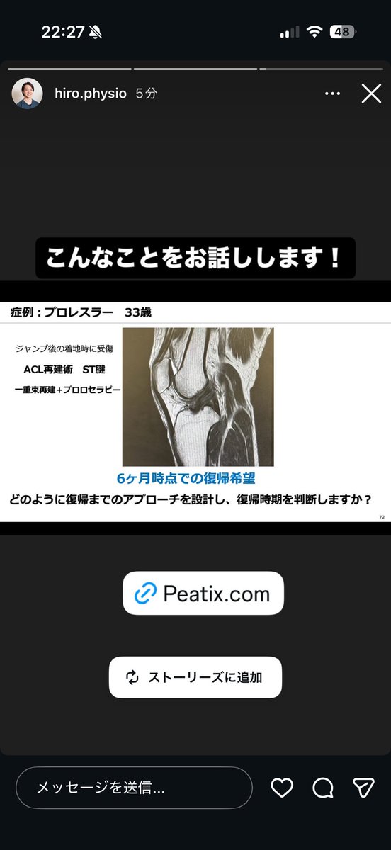 OomuroUta's tweet photo. トップアスリートのACL再建後の超早期復帰に関わられている大宮さんのお話しです！

シビアな環境でどうやって結果を出すか？
科学に裏打ちされた具体的なアプローチを熱く語って頂きます！
@Spo_Lab 

https://t.co/NJDeXjmiwM https://t.co/Fb9fVaaMVj