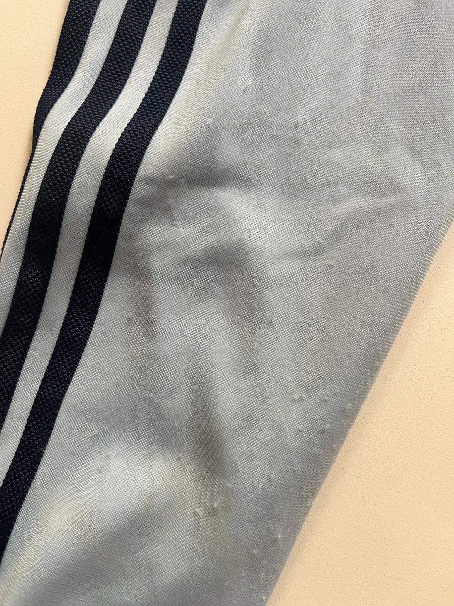 MrBurno's tweet photo. @adidas @adidasoriginals one day's use on my daughter's 10th b'day. Bobbling already as per the images. Being told there is nothing you can do, exchange refused. Is this how you treat loyal customers? My ten year old still without her present! https://t.co/kXLMYkFBwQ