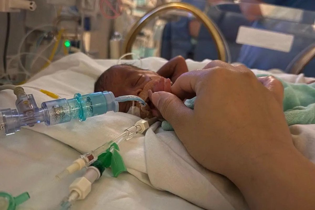 LiveAction's tweet photo. Baby Zayd was born prematurely at 23 weeks

He weighed 1.2lbs, and was small enough to fit in the palm of his mother’s hand

After 123 days in the NICU, he went home to be with his family

Baby Zayd is a reminder that every baby’s life is a gift https://t.co/UCyeDQjaoM