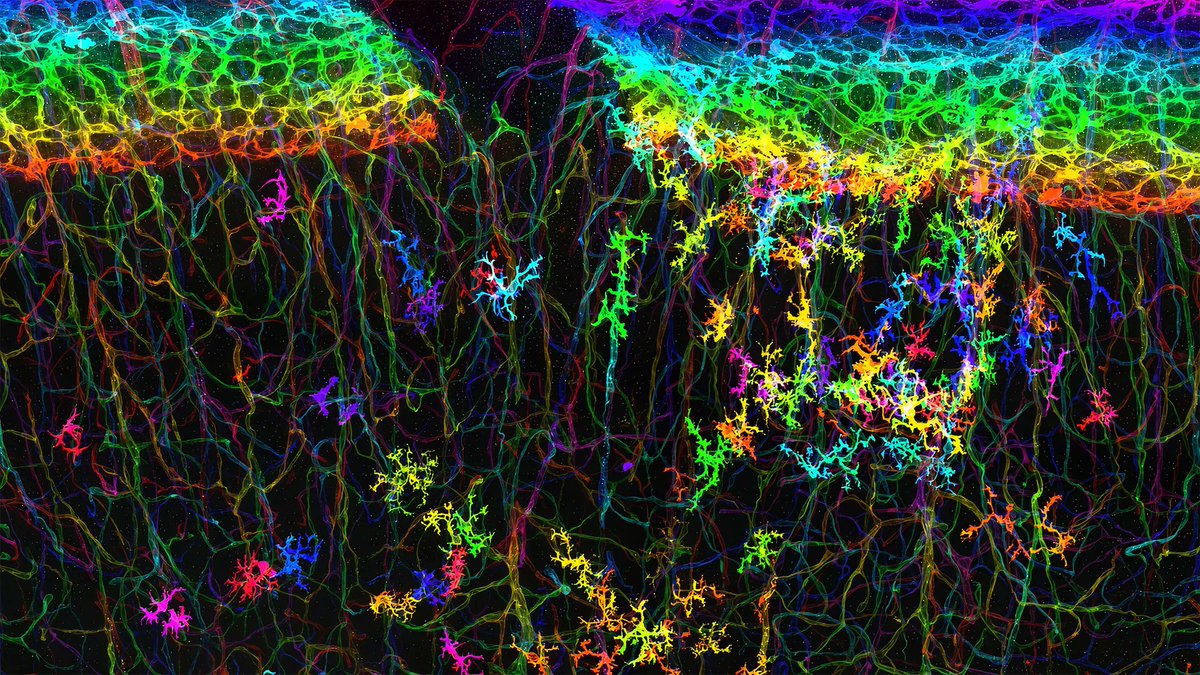 USBrainAlliance's tweet photo. Enter the 2026 BRAIN Photo & Video Contest by July 2, 11:59 PM ET. Share your visual storytelling and bring neuroscience to life for the BRAIN community. https://t.co/oZbNtcK4oP
Submit now! #studyBRAIN https://t.co/2C7XPtkLbk