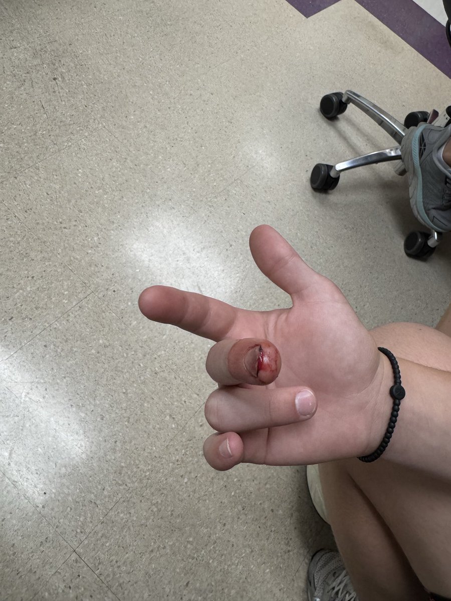 jeremyrmiller's tweet photo. Drew just can’t seem to catch a break this baseball season. During a game last night, he fractured his finger fielding a hard hit ball. The play resulted in a double play, but unfortunately he will miss some time while his finger heals. Never a dull moment. https://t.co/BfDkWA5UQE