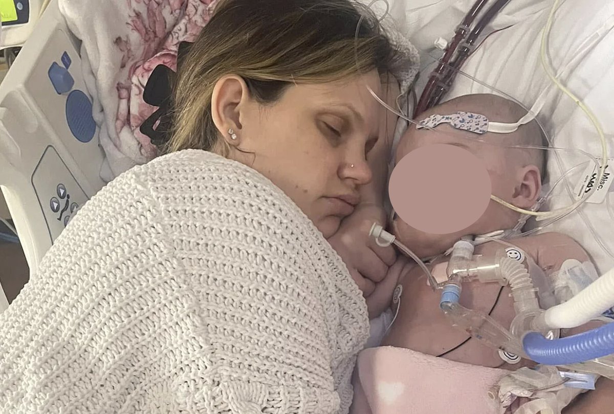 ELSOOrg's tweet photo. A machine, a baby girl &amp; a 289-day miracle. Read about Aubrey, treated by team of @DrGilesPeek at @UFHealth! 🍼 https://t.co/49ya1sUuNe

Case is described in a manuscript published by @asaiojournal: longest reported run for PARDS due to LRTI. #PedsICU
🖇️ https://t.co/xNjXPwQCQA https://t.co/XEEN9engFm