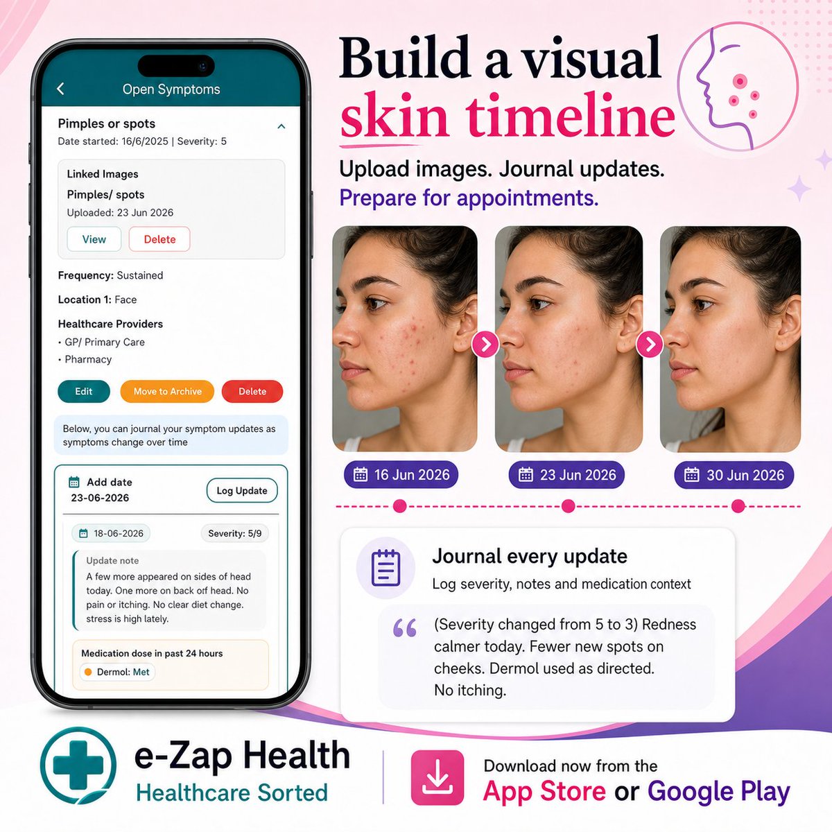 eZapHealth's tweet photo. Journal skin conditions as the appearance changes over time, so that you can provide a clinician with a more precise summary. 

e-Zap's smart image hub, symptom tracker &  AI-assisted insights tool, all combine to give you improved preparation for your appointments.

#acne #skincare #healthtracker #healthapp #healthtech #mobilehealth #healthAI #symptomtracker
