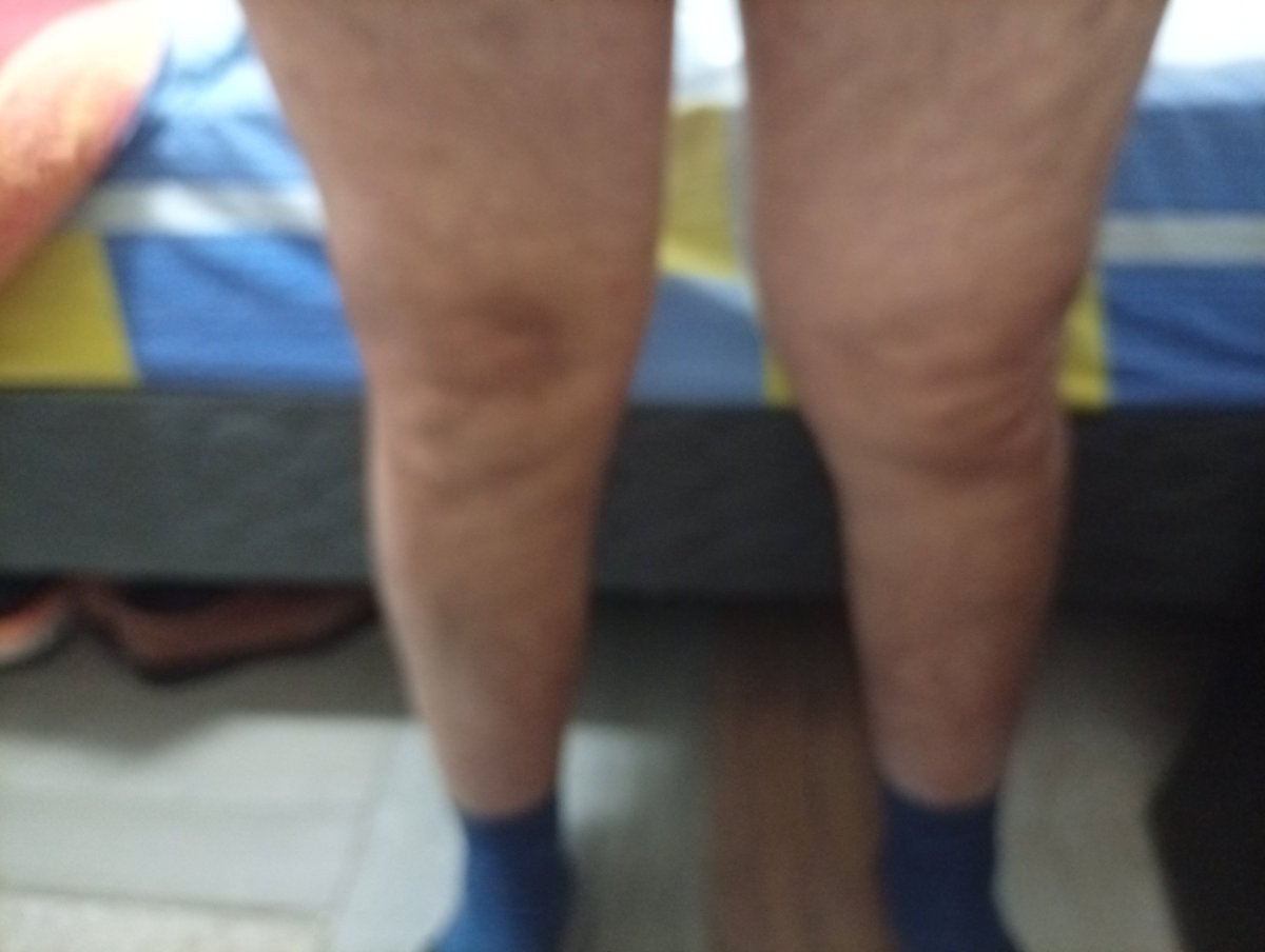 elmaduro_56's tweet photo. Esperando un colágeno para este adulto de 57 años en chile https://t.co/7WsSiYnS8W